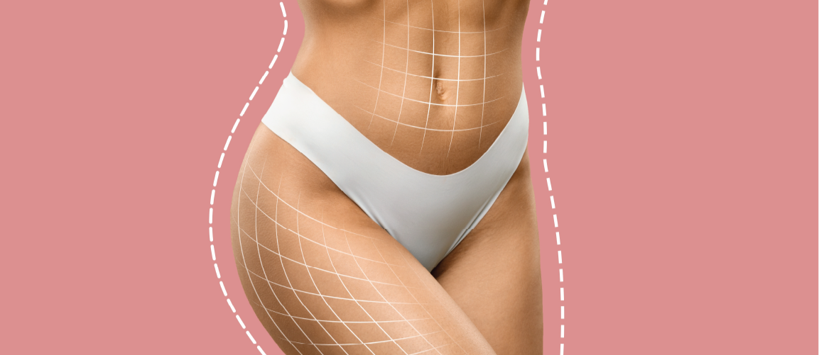 A close-up of a woman's midsection and lower abdomen, wearing white underwear. The area is overlaid with a grid pattern to indicate body contouring or fat reduction, with a pink background.