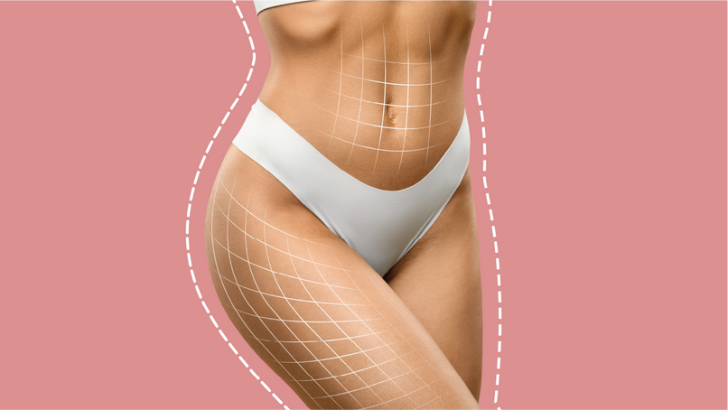 A close-up of a woman's midsection and lower abdomen, wearing white underwear. The area is overlaid with a grid pattern to indicate body contouring or fat reduction, with a pink background.